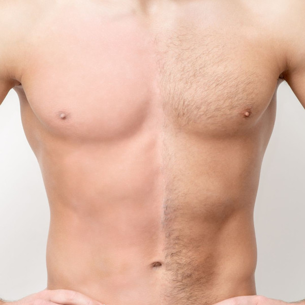Depilación laser: Piernas completas + torax + línea alba